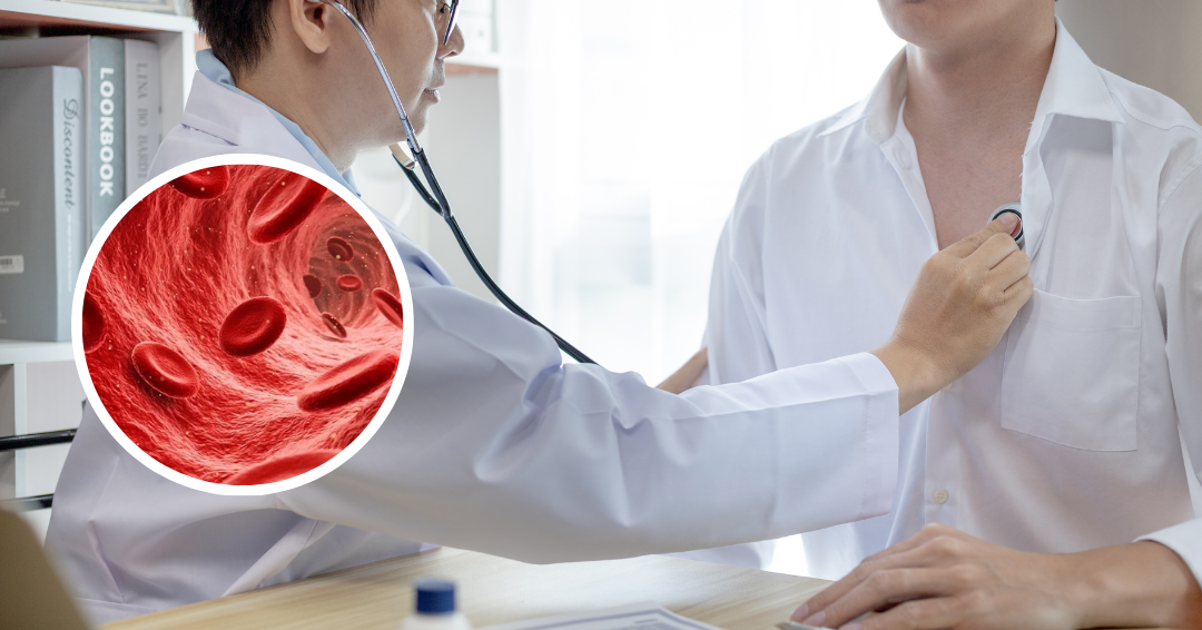 Why Humans Are Prone to Coronary Artery Disease – Part 3