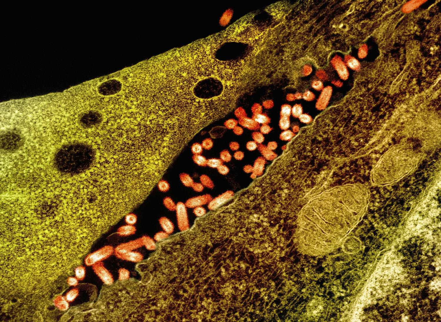 Comprehensive Guide: Fighting Biofilms with Foods, Nutraceuticals, Supplements, Herbs, and Protocols